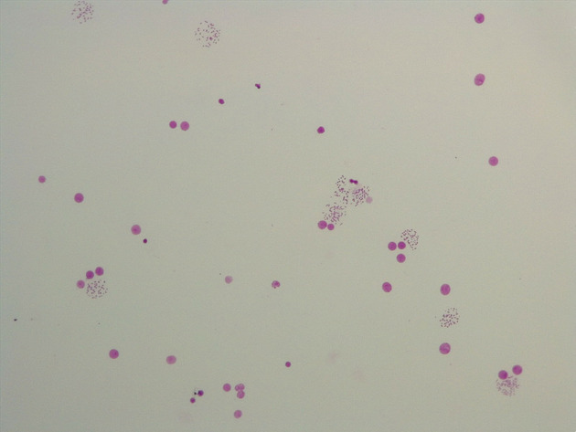 Female Chromosomes Slides - Female Chromosomes 02 100X